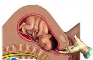 小宝宝胎头何时入盆？胎头入盆后多久会分娩？