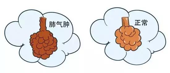 世界最新十大死亡疾病排名,世界最可怕的疾病排名