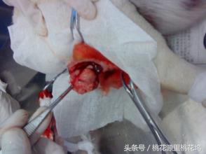 如果长了脂肪瘤怎么办？憋激动，淡然除之