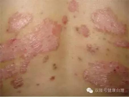 中医说吃醪糟的好处,中医说伤阴最严重症状