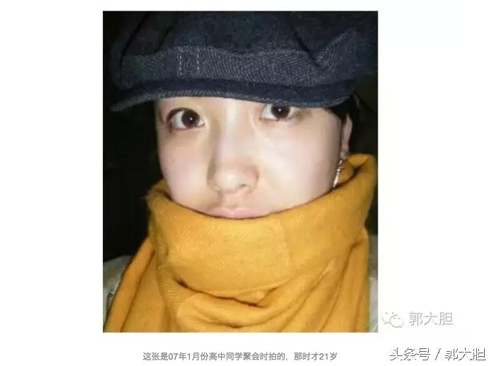 当你以为抗老还要靠超声刀的时候,我去打了更牛X的热拉提