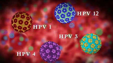 眼睛上边有个小颗粒,眼睛上有个米粒大小的颗粒