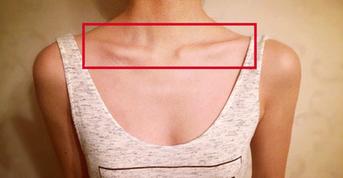 这些症状你都知道吗医学科普,这些症状或许是癌的征兆英语翻译