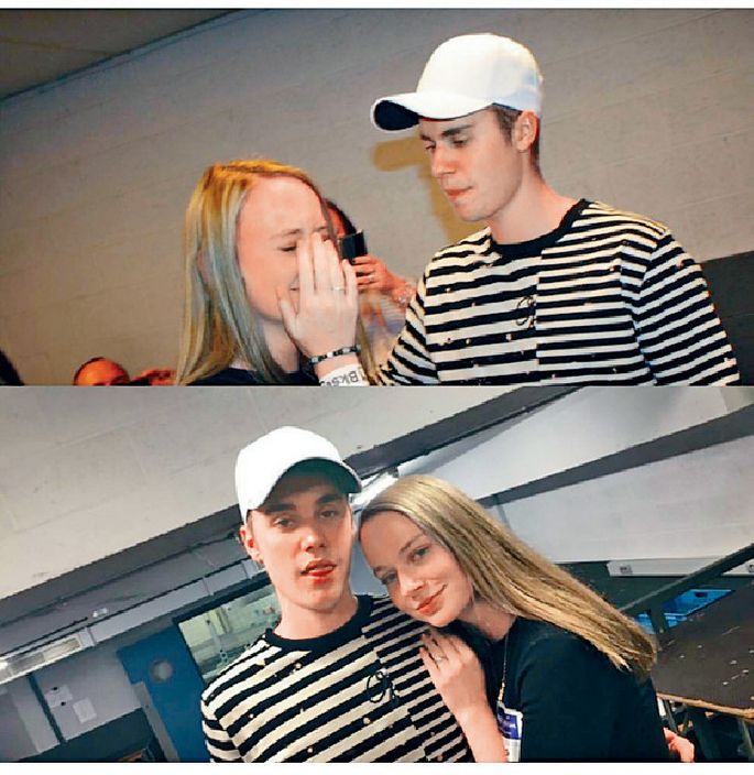 比伯贾斯汀街头,贾斯汀比伯自曝出现面瘫