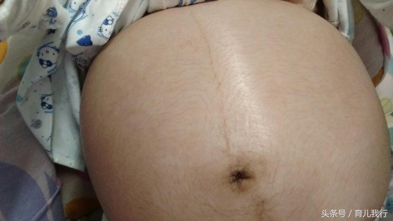 肚脐眼突出有怀女孩的吗,肚脐眼凸起就是怀的儿子