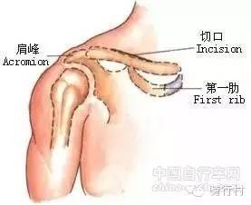经验：必读，自行车尺寸导致的5种运动损伤！