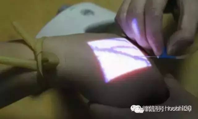 如何扎针不痛,怎么扎针才能不疼