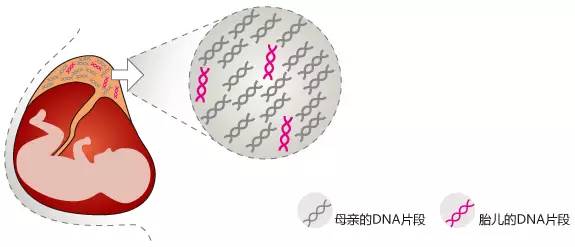 产前无创dna检测是什么,无创产前dna检测21三体0.06正常吗