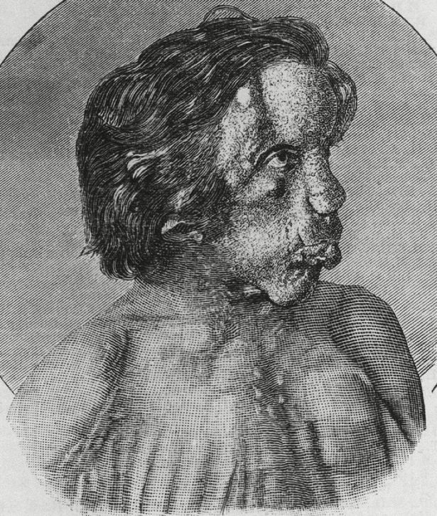 丑人俱乐部,丑人俱乐部有哪些