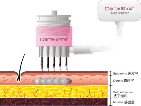 整容脸肿网红,整容包子脸网红