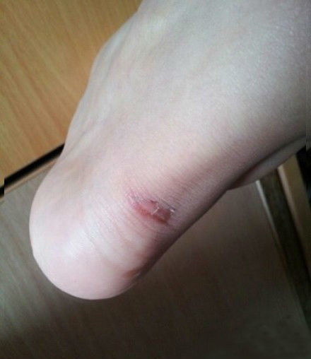 爱美的你一定有这样的血泪史,高跟鞋穿久了就会磨脚,你想解除新鞋磨脚、夹脚的苦恼吗?