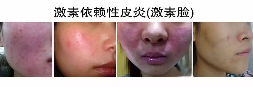 微商上的护肤品是骗人的吗,微商被人欺诈怎么办