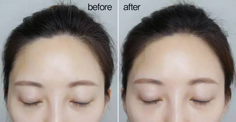 发际线决定人的智商,发际线决定气质