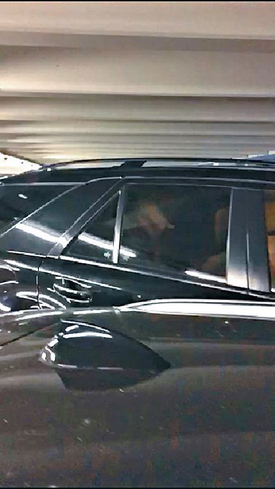 比伯贾斯汀街头,贾斯汀比伯自曝出现面瘫