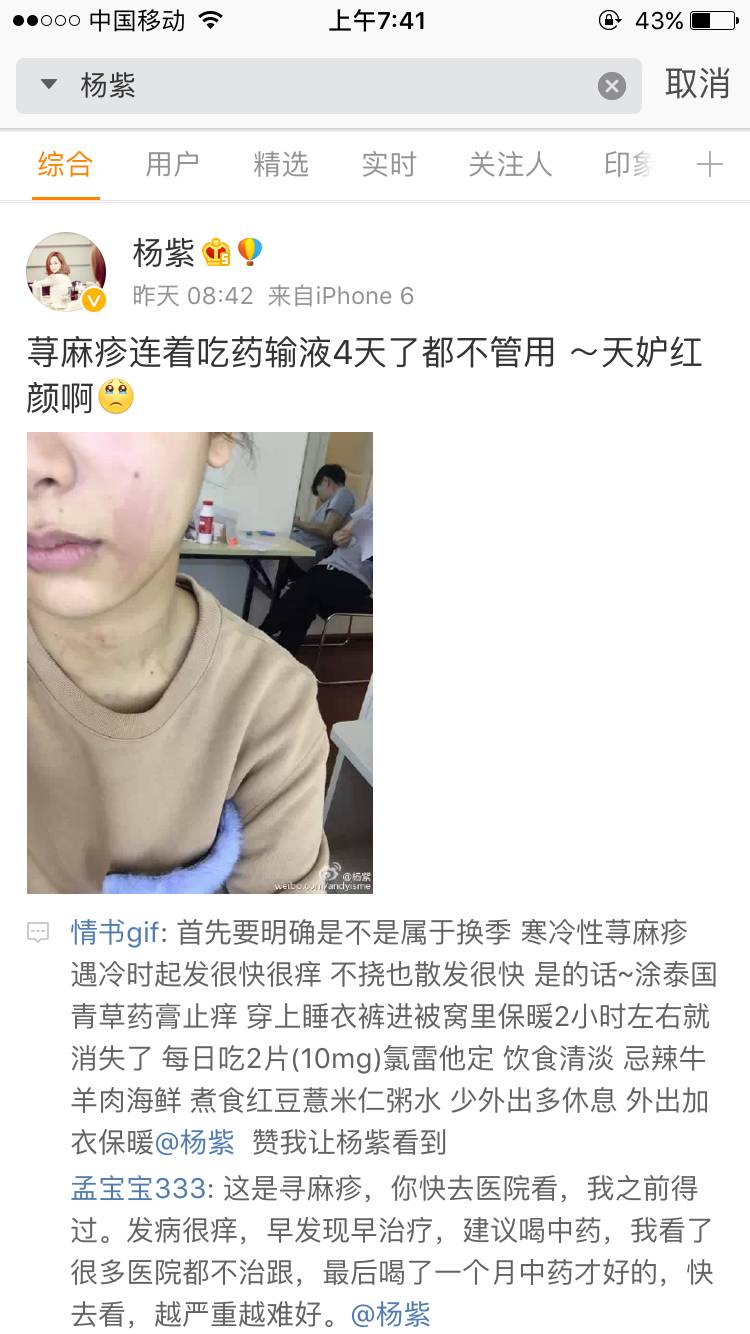 杨紫自爆过敏严重似毁容,难道她的护肤品是假货?