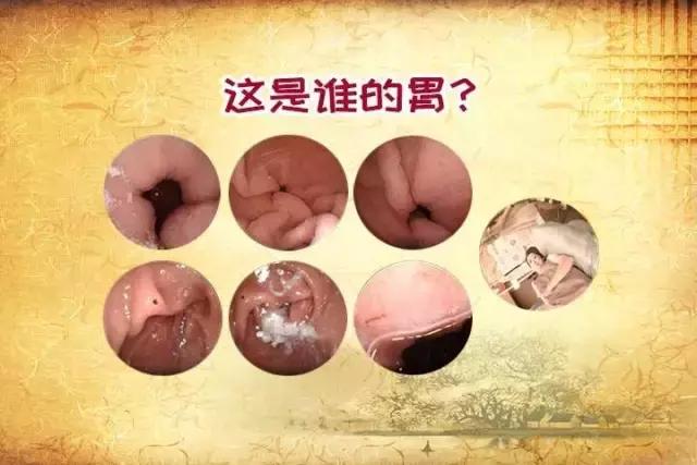 对号入座|事业胃，神经胃，美食胃，金属胃，你是哪种胃？