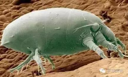 有螨虫的皮肤该怎么处理,螨虫真的和皮肤没有关系吗