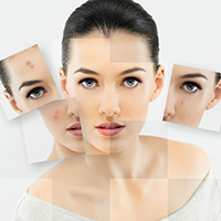 *疮痤**“病因、治疗、预防”这里都有，你不看就错过了！