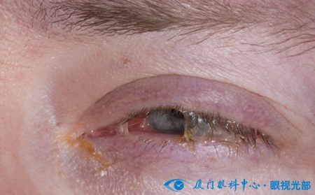 关于眼屎你还知道哪些知识,通过眼睛识人的口诀