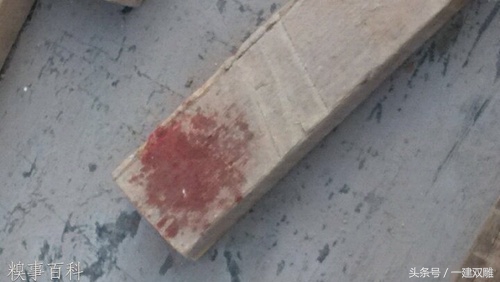 在施工的地方被钉子扎了脚怎么办,工地上脚扎了钉子怎么处理好得快