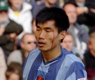 心疼！内少血染赛场足坛那些血染赛场的硬汉们