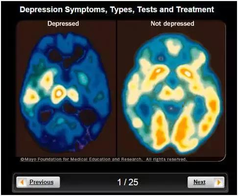 如果你身边人抑郁了,请别只说“想开点”
