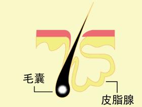 黑头反复长是什么原因,黑头为什么老是反复