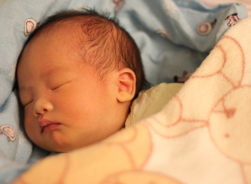 新生儿黄疸有哪些症状多久能退,新生儿黄疸一般出现哪几天