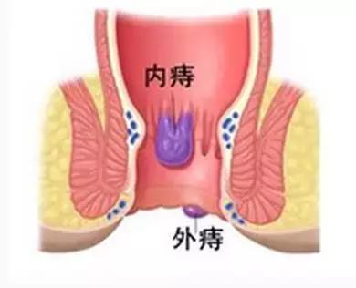 过了嘴瘾，上面舒服下面受折磨怎么破？