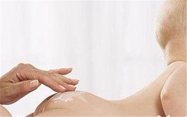 宝宝的尿布疹反复发作,宝宝有尿布疹和颈部皮疹