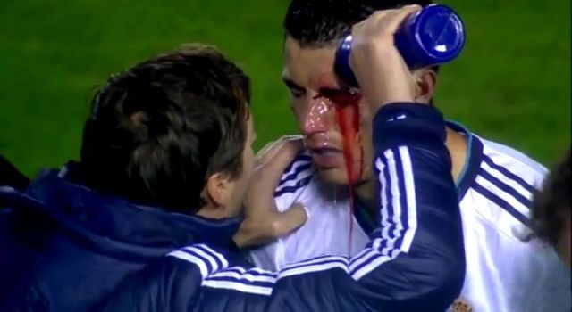 心疼！内少血染赛场足坛那些血染赛场的硬汉们