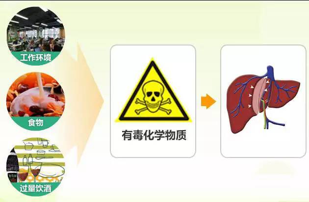 化学性肝损伤什么意思,怎么知道自己有没有化学性肝损伤