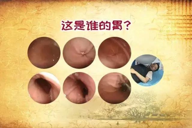 对号入座|事业胃，神经胃，美食胃，金属胃，你是哪种胃？