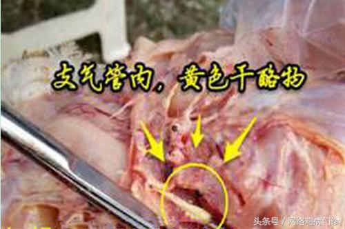 支气管痰多堵塞的症状和危害,支气管堵塞能做手术是微创吗