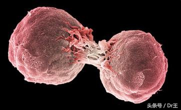 虽没化疗快速,让癌细胞自动凋亡!罹癌率降低73%!堪比偏方!