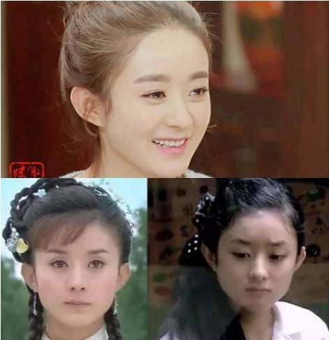 拯救发际线扁塌头发,拯救发际线告别大额头