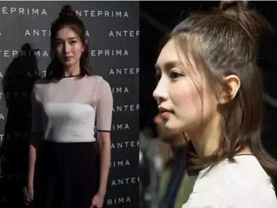 拯救发际线扁塌头发,拯救发际线告别大额头