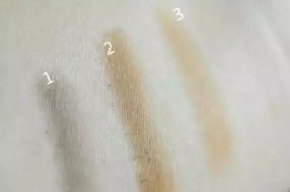 拯救发际线扁塌头发,拯救发际线告别大额头