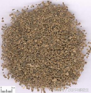 外阴湿疹瘙痒中药治疗,瘙痒性湿疹妇科