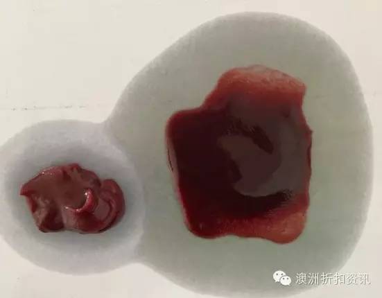 香港新闻报道广西蔓越莓,真的假的蔓越莓