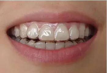 好看的牙印纹身,镶钻牙齿