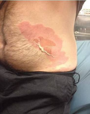 用有涂层的不锈钢锅有危害吗,铸铁锅不粘锅有毒吗