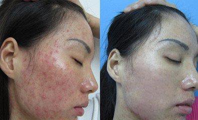 芦荟胶的妙用你知道吗,芦荟胶有什么用科普