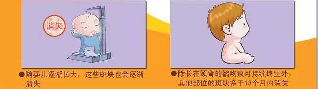 宝宝身上有哪些胎记,有胎记的小孩儿是不是天使