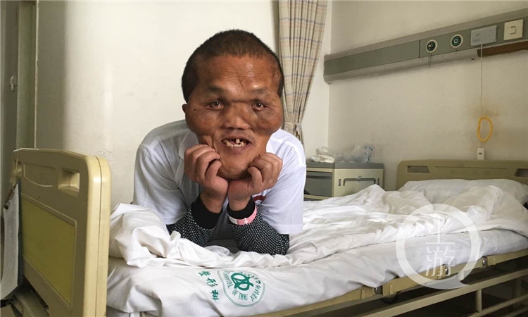 “外星人”男子来重庆主城逆袭:想整容!