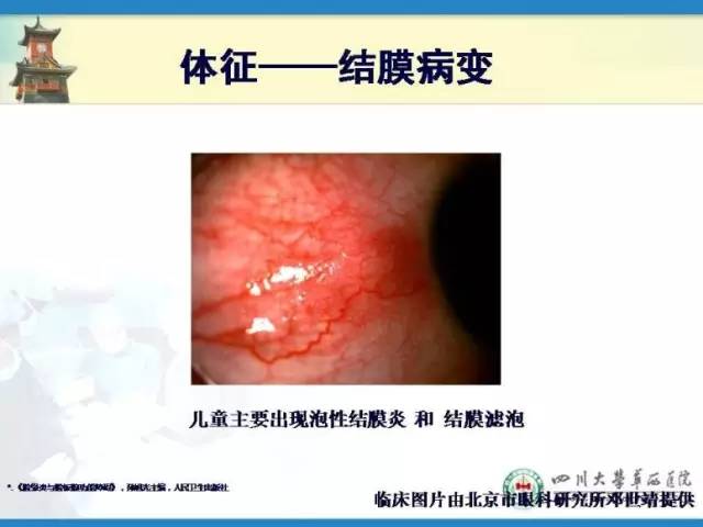 邓应平坐诊医院,邓应平成都坐诊