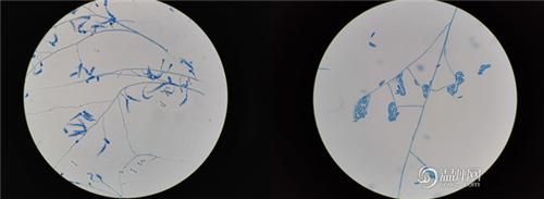 温医大医学检验,温医大检验医学院博士
