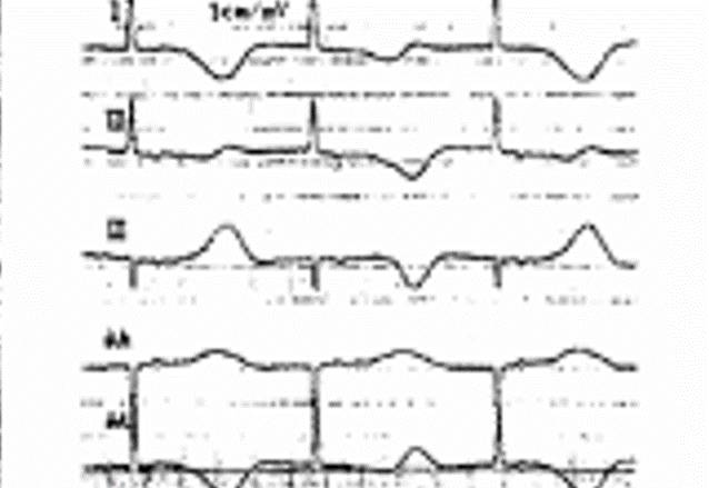 胺碘酮的十六种危险用法,胺碘酮的十六种致命顺口溜
