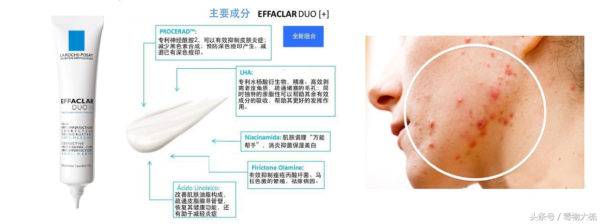 祛痘打假测评,祛痘产品良心测评打假