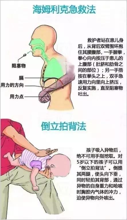 宝宝意外摔伤了怎么办呢,宝宝意外受伤了